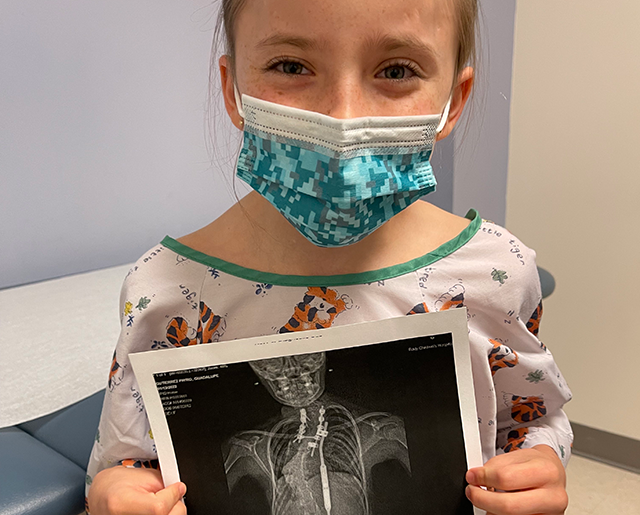 young girl wearing mask and holding x-ray image